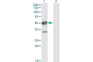 Western Blot analysis of SFRS17A expression in transfected 293T cell line by SFRS17A monoclonal antibody (M02), clone 2G8.