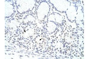 ZNF580 antibody was used for immunohistochemistry at a concentration of 4-8 ug/ml to stain Epithelial cells of fundic gland (arrows) in Human Stomach.