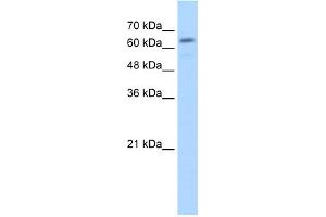 WB Suggested Anti-GUSB Antibody Titration:  2. (Glucuronidase beta antibody  (C-Term))