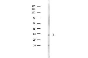 Western blot analysis of lysates from F10-LUC cells(starvation 24h treatment), using FAM181A Antibody at 1/1000 dilution. (FAM181A antibody)