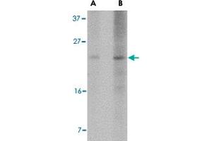 Western blot analysis of BBC3 expression in K-562 cell lysate with BBC3 monoclonal antibody, clone 2A8F6  at (A) 2. (PUMA antibody  (AA 76-170))