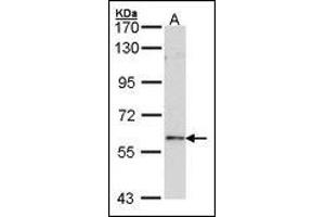 Sample (30 ug of whole cell lysate). (FOXN1 antibody)