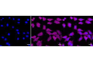 Immunocytochemical staining of C2C12 cells with Galectin 1 antibody (ABIN7799243), 1:1,000). (Recombinant LGALS1/Galectin 1 antibody)
