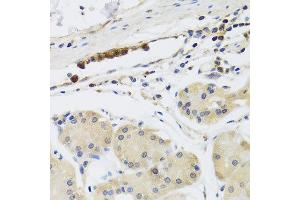 Immunohistochemistry of paraffin-embedded human gastric using MB21D1 antibody at dilution of 1:100 (x40 lens). (C6orf150 antibody)