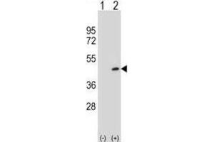 Western Blotting (WB) image for anti-Protein Arginine Methyltransferase 6 (PRMT6) antibody (ABIN2995520) (PRMT6 antibody)