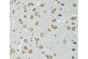 Immunohistochemistry of paraffin-embedded Mouse brain using RNASEL Polyclonal Antibody at dilution of 1:100 (40x lens). (RNASEL antibody)