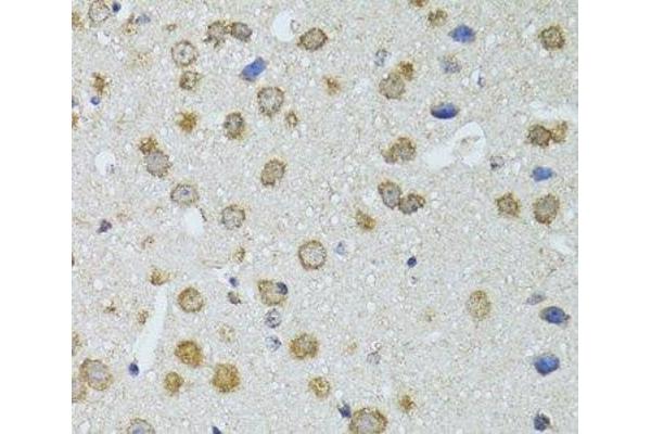 RNASEL antibody
