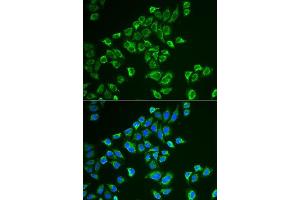 Immunofluorescence analysis of HeLa cells using TAGLN antibody. (Transgelin antibody  (AA 1-201))