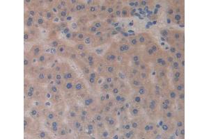 IHC-P analysis of Rat Tissue, with DAB staining. (SLIT3 antibody  (AA 453-516))