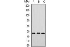 Western blot analysis of AP1-mu-2 expression in HepG2 (A), mouse kidney (B), mouse lung (C) whole cell lysates. (AP1m2 antibody)