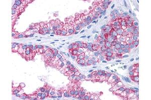 Anti-EPB41L2 antibody IHC of human prostate. (EPB41L2 antibody  (AA 481-530))
