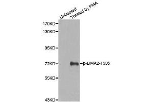 Western blot analysis of extracts from HeLa cells, using Phospho-LIMK2-T505 antibody (ABIN2988124). (LIMK2 antibody  (pThr505))