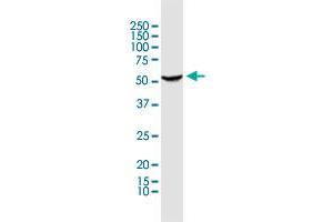Western Blotting (WB) image for anti-Pre-mRNA Processing Factor 31 (PRPF31) (AA 400-499) antibody (ABIN949177)