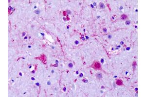 Anti-GPR75 antibody IHC of human brain, cortex, neurons. (GPR75 antibody  (Cytoplasmic Domain))