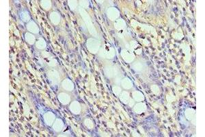 Immunohistochemistry of paraffin-embedded human colon tissue using ABIN7161654 at dilution of 1:100 (NLRC4 antibody  (AA 1-250))
