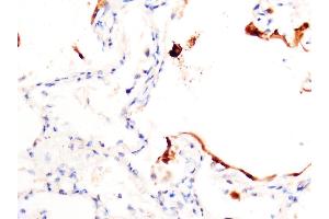 Immunohistochemistry (IHC) image for anti-SARS-CoV-2 Spike (C-Term) antibody (ABIN1030641)