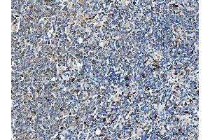 IHC analysis of ARHGAP45 using anti-ARHGAP45 antibody (ABIN7599740). (HMHA1 antibody  (AA 111-349))