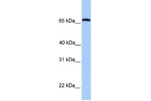 WB Suggested Anti-CCIN Antibody Titration: 0. (Calicin antibody  (C-Term))