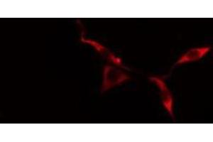 ABIN6275383 staining  MCF7 cells by IF/ICC. (KCNG3 antibody  (Internal Region))