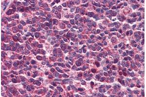 Human Tonsil: Formalin-Fixed, Paraffin-Embedded (FFPE) (DENND1B antibody  (AA 144-193))