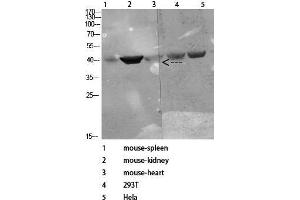 Western Blot (WB) analysis of specific cells using Antibody diluted at 1:1000. (CD72 antibody)