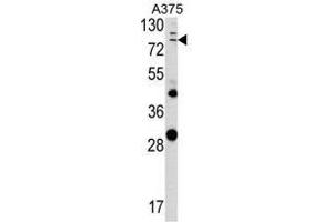 Image no. 1 for anti-Annexin A1 (ANXA1) (Middle Region) antibody (ABIN452740) (Annexin a1 antibody  (Middle Region))