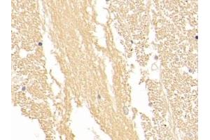 Detection of NSE in Human Cerebrum Tissue using Polyclonal Antibody to Enolase, Neuron Specific (NSE) (ENO2/NSE antibody  (AA 1-434))