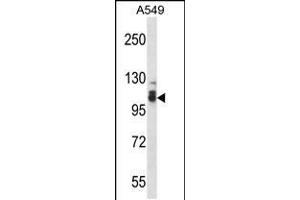 Western Blotting (WB) image for anti-SMEK Homolog 2, Suppressor of Mek1 (Dictyostelium) (SMEK2) (AA 720-748), (C-Term) antibody (ABIN5531876)