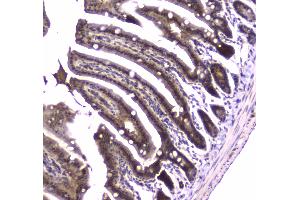 Immunohistochemistry (IHC) image for anti-Glutathione Reductase (GSR) (AA 256-522) antibody (ABIN5693151)