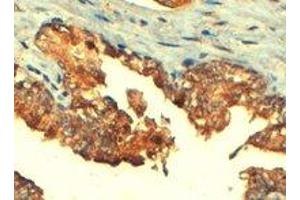 ABCC4 polyclonal antibody  (4 ug/mL) staining of paraffin embedded human prostate.