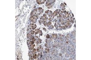 Immunohistochemical staining of human pancreas with SLC25A29 polyclonal antibody  shows moderate cytoplasmic positivity in exocrine glandular cells at 1:20-1:50 dilution.