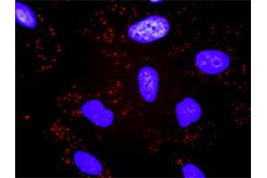 Proximity Ligation Analysis of protein-protein interactions between CACYBP and TBL1X. (TBL1X antibody  (AA 478-577))