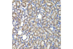 Immunohistochemistry of paraffin-embedded rat kidney using COPS2 antibody (ABIN5974233) at dilution of 1/100 (40x lens). (COPS2 antibody)
