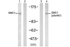 Western blot analysis of extract from K562 cells, untreated or treated with UV (20min), using SMC1 (Ab-957) antibody (E021190, Lane 1 and 2) and SMC1 (phospho-Ser957) antibody (E011198, Lane 3 and 4). (SMC1A antibody  (pSer957))