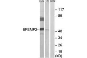 Western blot analysis of extracts from K562/NIH-3T3 cells, using EFEMP2 Antibody. (FBLN4 antibody  (AA 91-140))