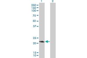 Western Blot analysis of RAB7L1 expression in transfected 293T cell line by RAB7L1 MaxPab polyclonal antibody. (RAB7L1 antibody  (AA 1-203))