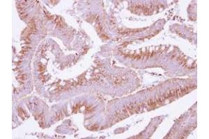 Image no. 1 for anti-Cytochrome C Oxidase Assembly Homolog 15 (COX15) (AA 178-410) antibody (ABIN1497579) (COX15 antibody  (AA 178-410))
