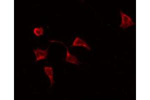 ABIN6269246 staining HeLa by IF/ICC. (STAT6 antibody  (Internal Region))