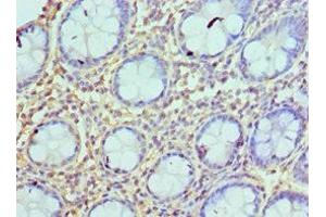 Immunohistochemistry of paraffin-embedded human colon tissue using ABIN7145136 at dilution of 1:100 (Azurocidin antibody  (AA 27-251))
