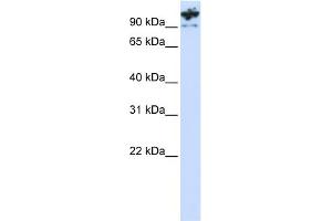 WB Suggested Anti-PCDHA6 Antibody Titration:  0. (PCDHA6 antibody  (C-Term))