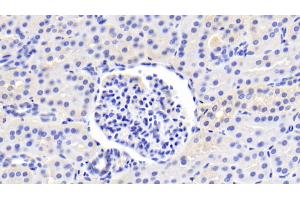 Immunohistochemistry (IHC) image for anti-Heme Oxygenase (Decycling) 1 (HMOX1) (AA 61-172) antibody (ABIN7437434)