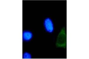 IF analysis of HPV-18 E2 protein in U2OS cells. (Human Papilloma Virus 18 E2 (HPV-18 E2) (AA 1-83) antibody)