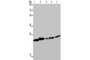 Western Blotting (WB) image for anti-rho GDP Dissociation Inhibitor (GDI) alpha (ARHGDIA) antibody (ABIN2423524) (ARHGDIA antibody)