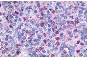 Anti-CCR2 antibody  ABIN1048389 IHC staining of human spleen. (CCR2 antibody  (Extracellular Domain))