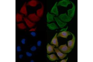 ABIN6259308 and ABIN6275426 staining Hela cells by IF/ICC.