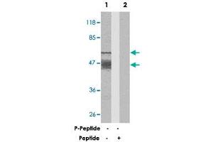Western blot analysis of extracts from mouse brain tissue using MAPT polyclonal antibody . (MAPT antibody)