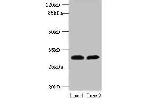 Western blot All lanes: TRNAU1AP antibody at 12 μg/mL Lane 1: MCF-7 whole cell lysate Lane 2: Jurkat whole cell lysate Secondary Goat polyclonal to rabbit IgG at 1/10000 dilution Predicted band size: 33, 21 kDa Observed band size: 33 kDa (TRNAU1AP antibody  (AA 33-156))