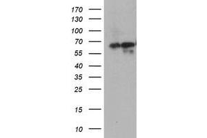 HEK293T cells were transfected with the pCMV6-ENTRY control (Left lane) or pCMV6-ENTRY ATIC (Right lane) cDNA for 48 hrs and lysed. (ATIC antibody)