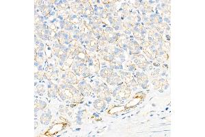 Immunohistochemistry analysis of paraffin-embedded rat stomach using Plectin Rabbit mAb at dilution of 1:1000 (40x lens). (PLEC antibody)