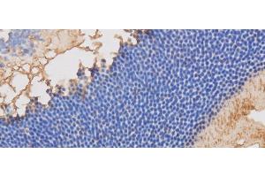 Immunohistochemistry of paraffin-embedded Mouse retina using RBP3 Polyclonal Antibody at dilution of 1:50 (RBP3 antibody)